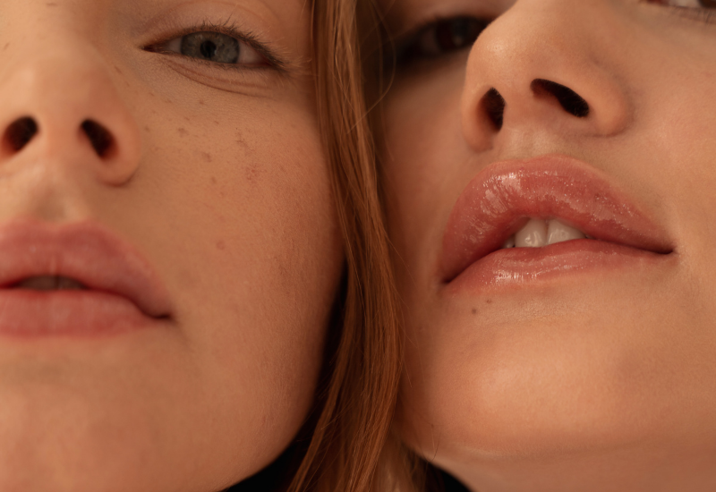 microchanneling facial near me, Hyperpigmentation facial near me, uneven skin tone facial Denver, brightening facial Denver, dark spot reduction facial, pigment correction facial, skin and chamomile with amber goodall